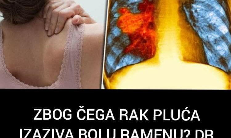 Pogledajte zašto rak pluća izaziva bolove u ramenu