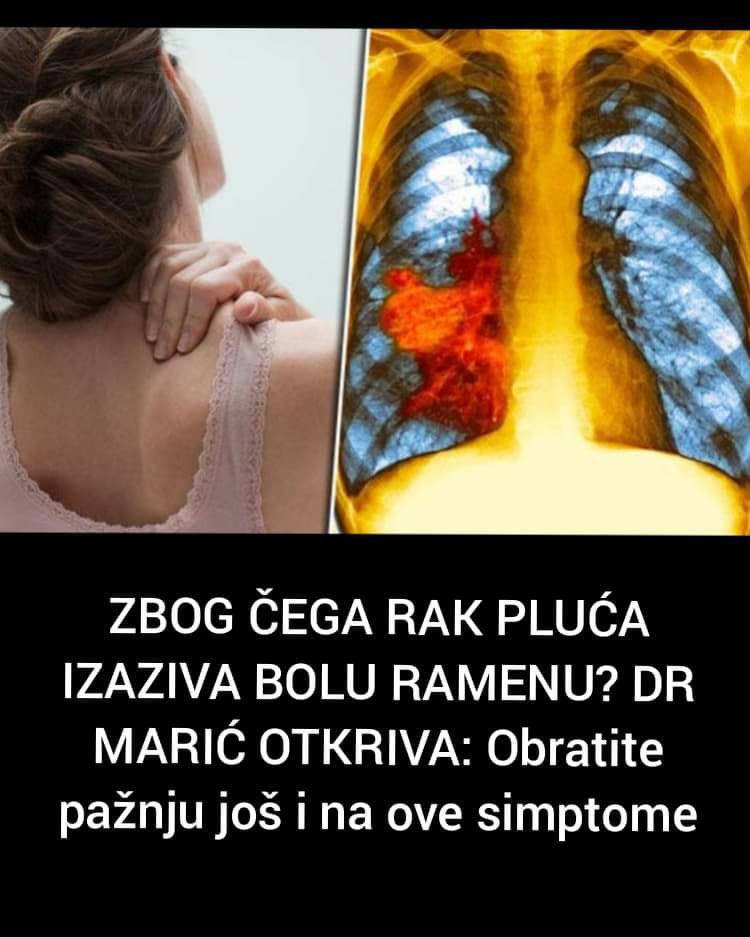 Pogledajte zašto rak pluća izaziva bolove u ramenu