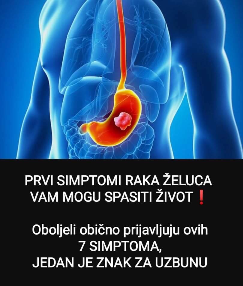 Pogledajte koji su to rani simptomi karcinoma želudca