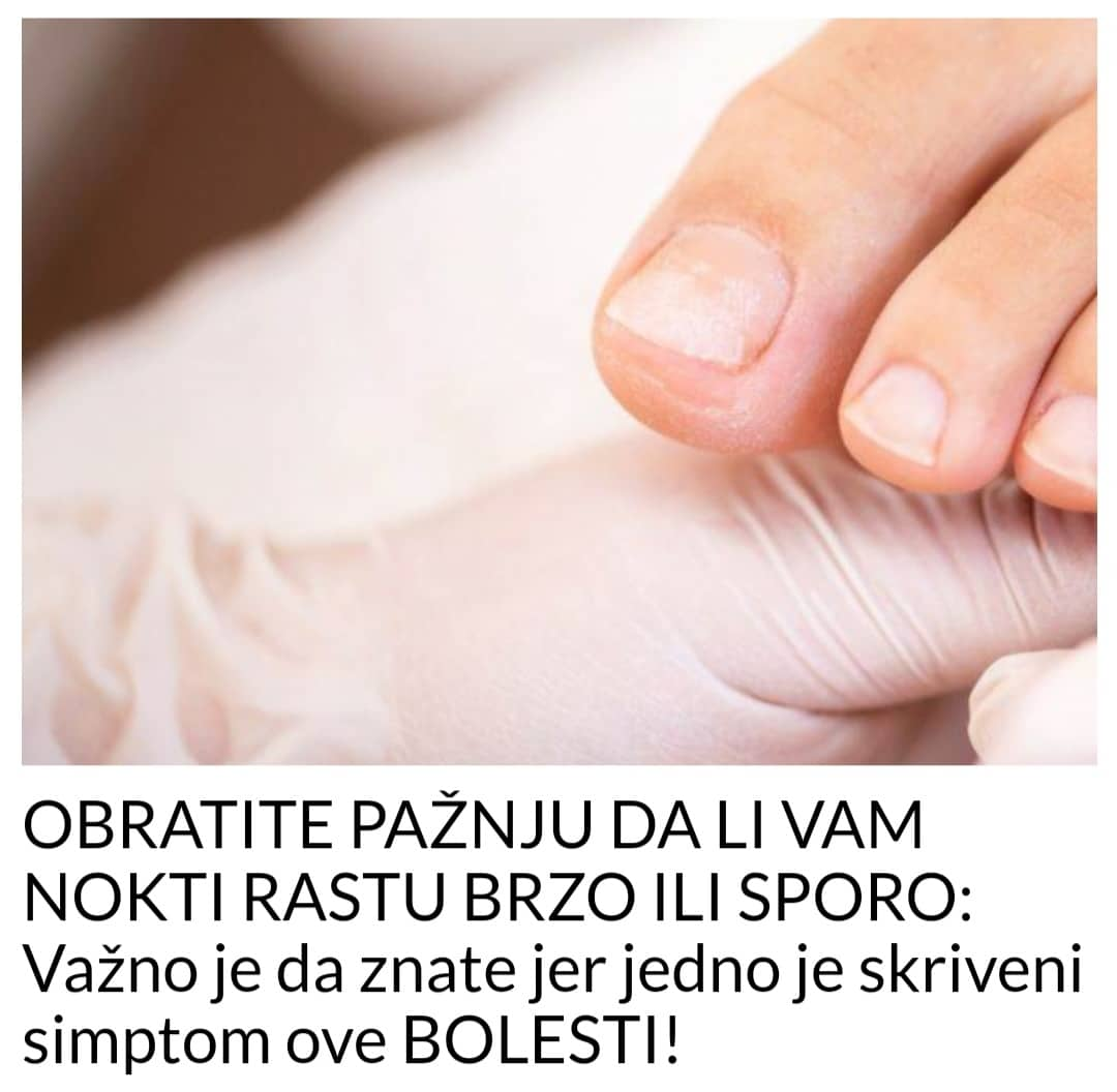 PROVJERITE DA LI VAM NOKTI RASTU SPORO ILI BRZO