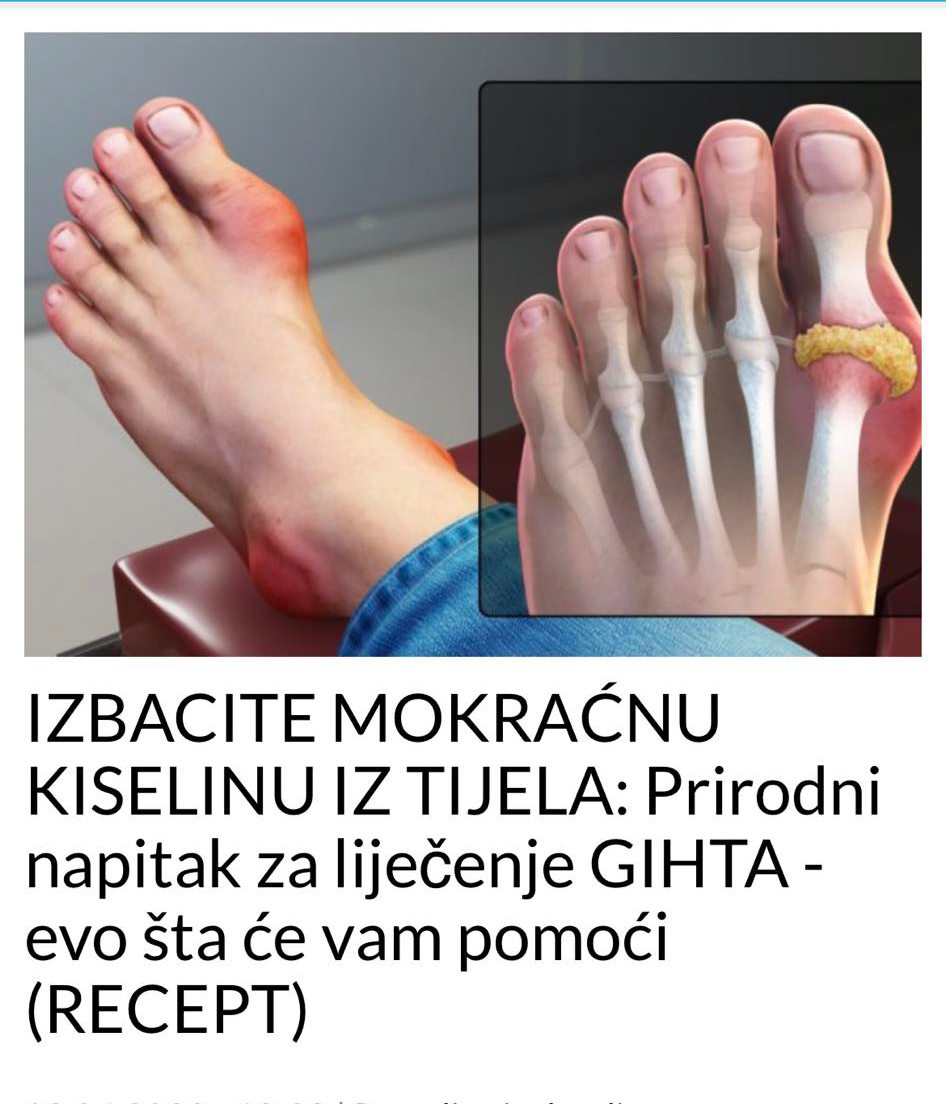 IZBACITE MOKRAĆNU KISELINU IZ TIJELA