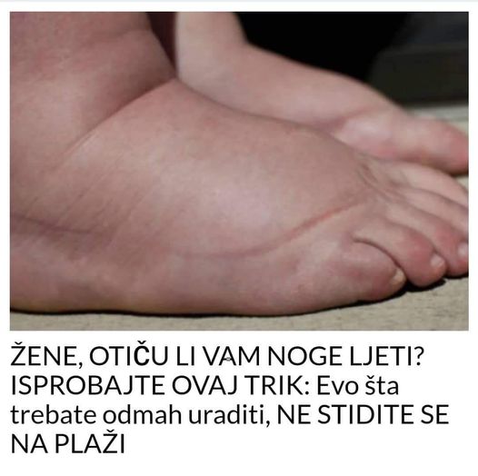 Evo šta morate odmah uraditi, NE STIDITE SE NA PLAŽI