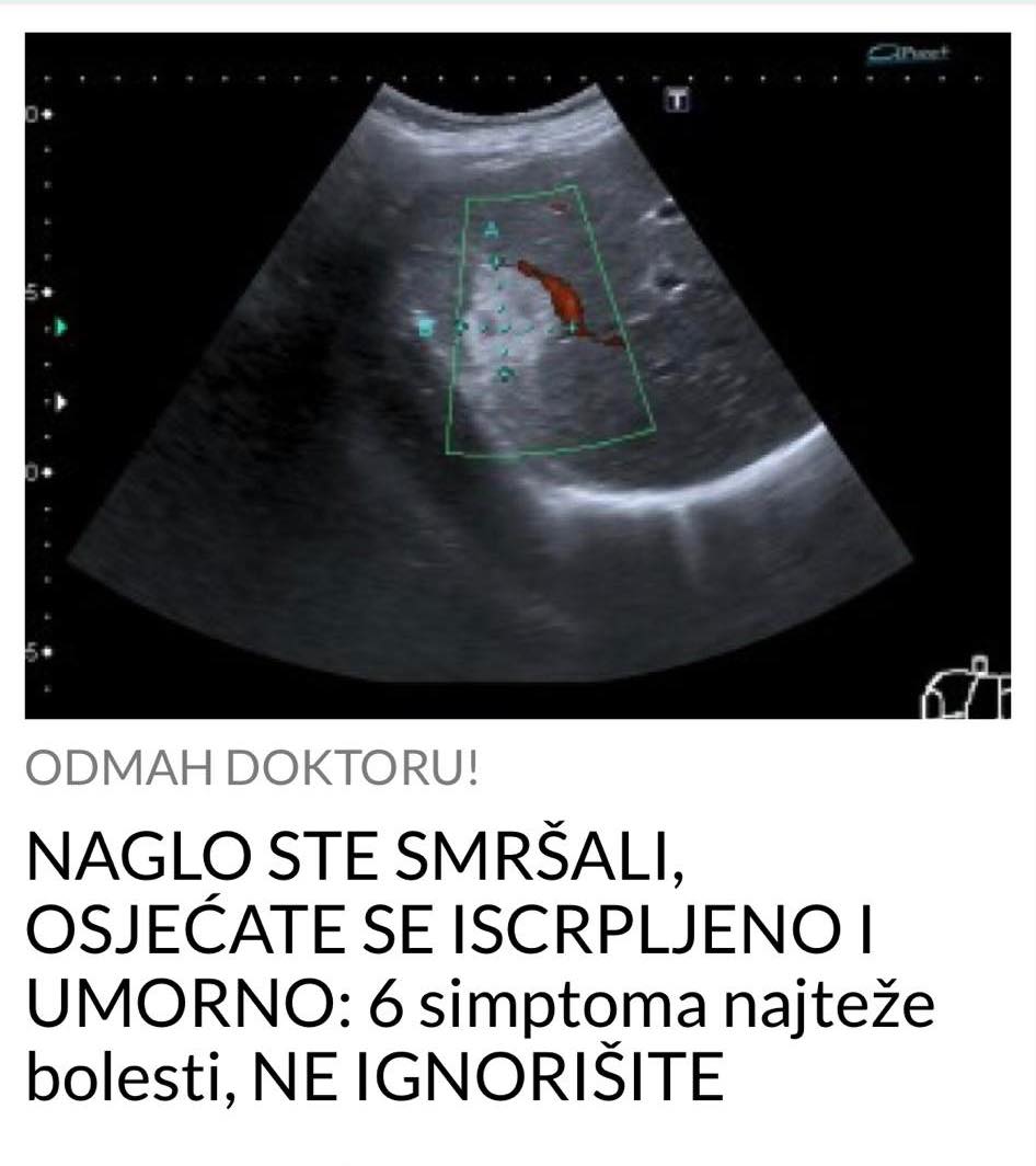 POGLEDAJTE KOJI SU TO SIMPTOMI NAJTEŽE BOLESTI