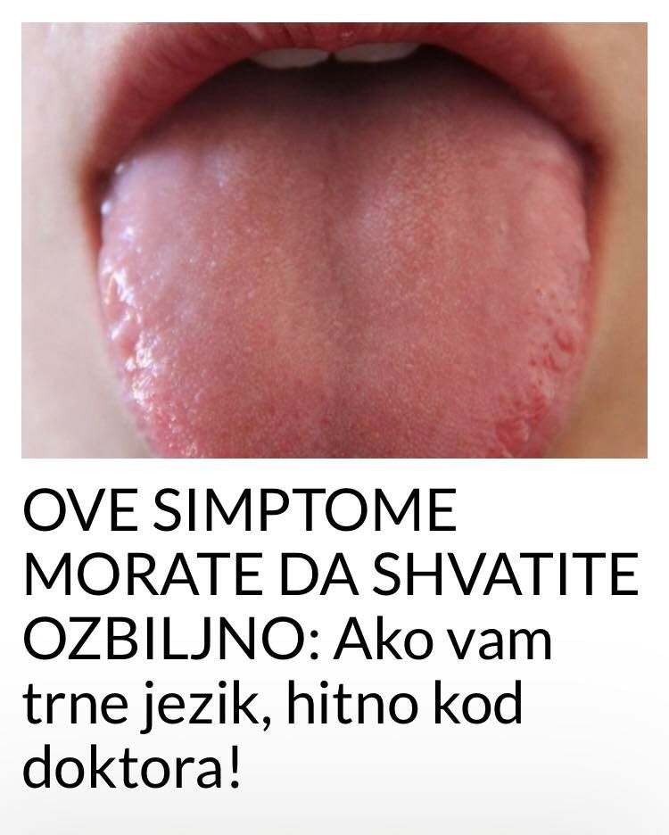 POGLEDAJTE KOJE SIMPTOME MORATE DA SHVATITE OZBILJNO