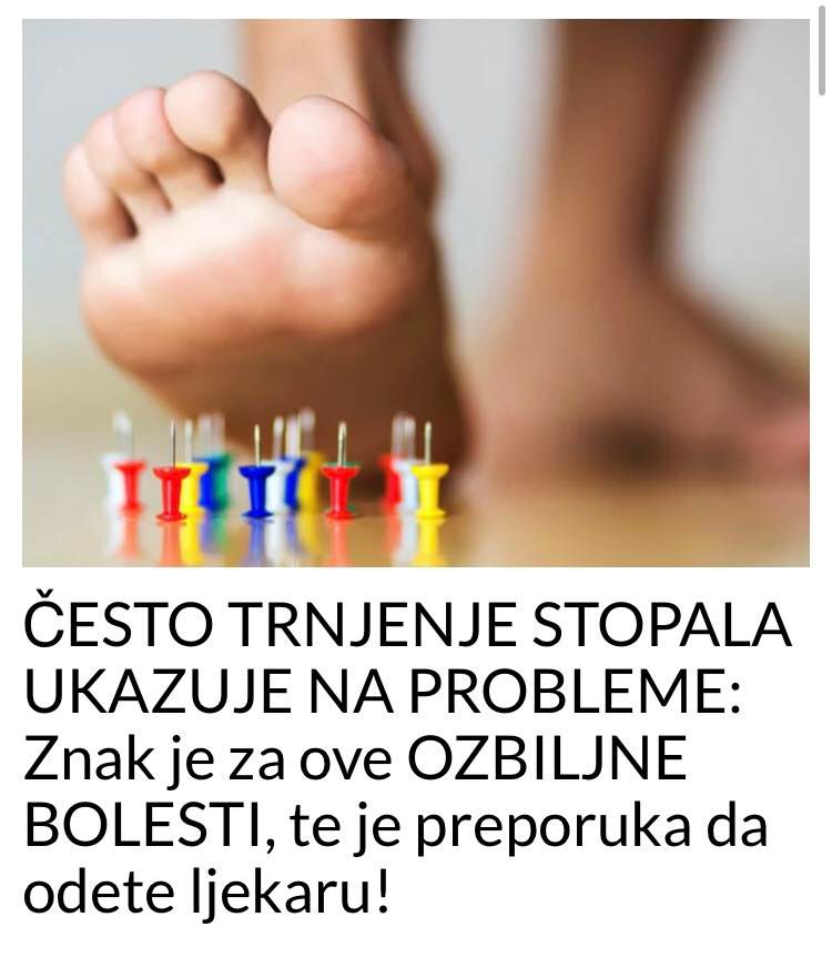 POGLEDAJTE NA KOJE BOLESTI UKAZUJE TRNJENJE STOPALA