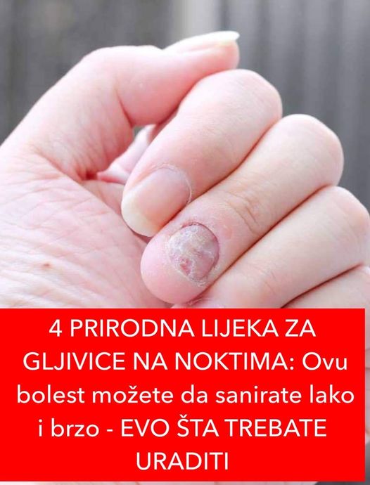 POGLEDAJTE KOJA 4 LIJEKA RJESAVAJU PROBLEM SA GLJIVICAMA!