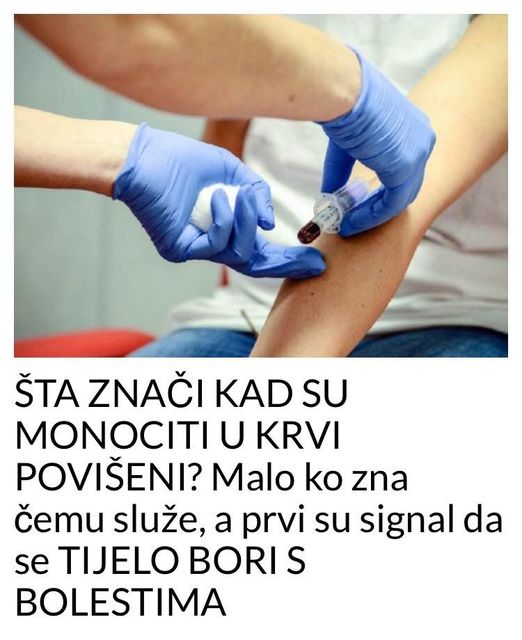 POGLEDAJTE STA ZNACI KADA SU MONOCITI U KRVI POVISENI