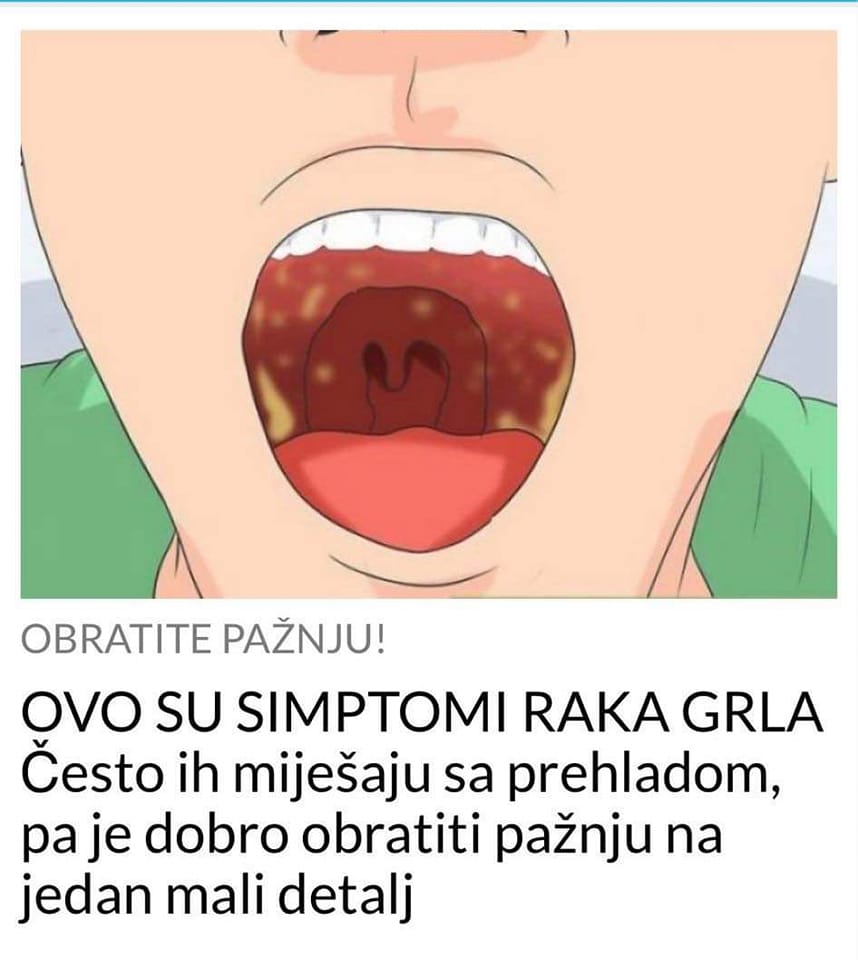 POGLEDAJTE KOJI SU TO SIMPTOMI RAKA GRLA