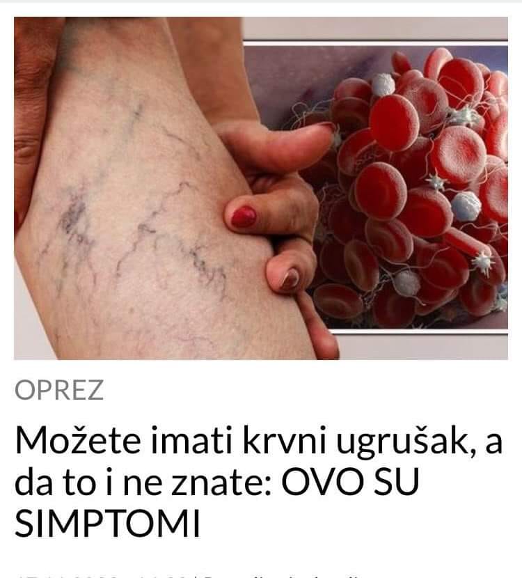 POGLEDAJTE KOJI SIMPTOMI UPUCUJU NA TO DA IMATE KRVNI UGRUSAK