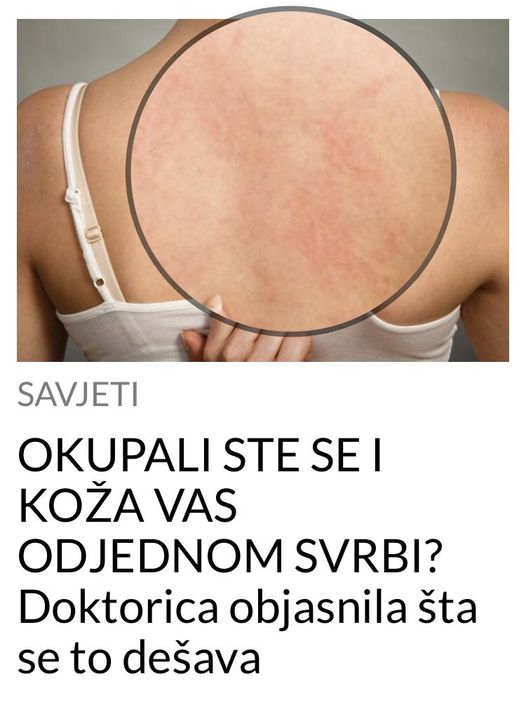 POGLEDAJTE KAKO SE RIJESITI SVRABA KOZE NAKON KUPANJA!