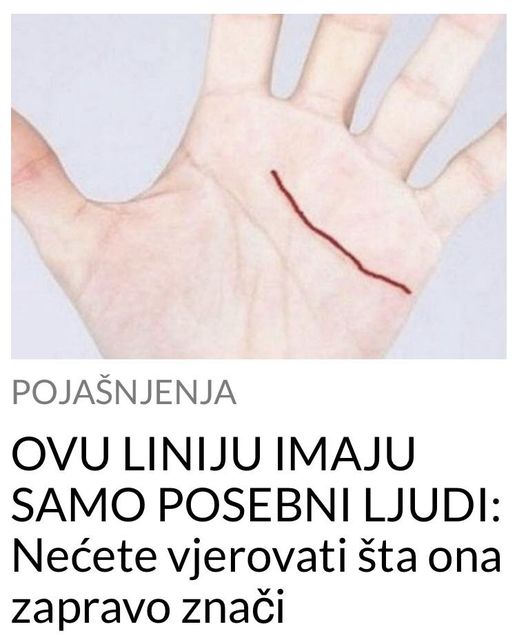 POGLEDAJTE KOJU LINIJU IMAJU SAMO POSEBNI LJUDI