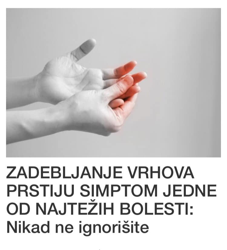 ZADEBLJANJE VRHOVA PRSTIJU SIMPTOM JEDNE OD NAJTEŽIH BOLESTI: