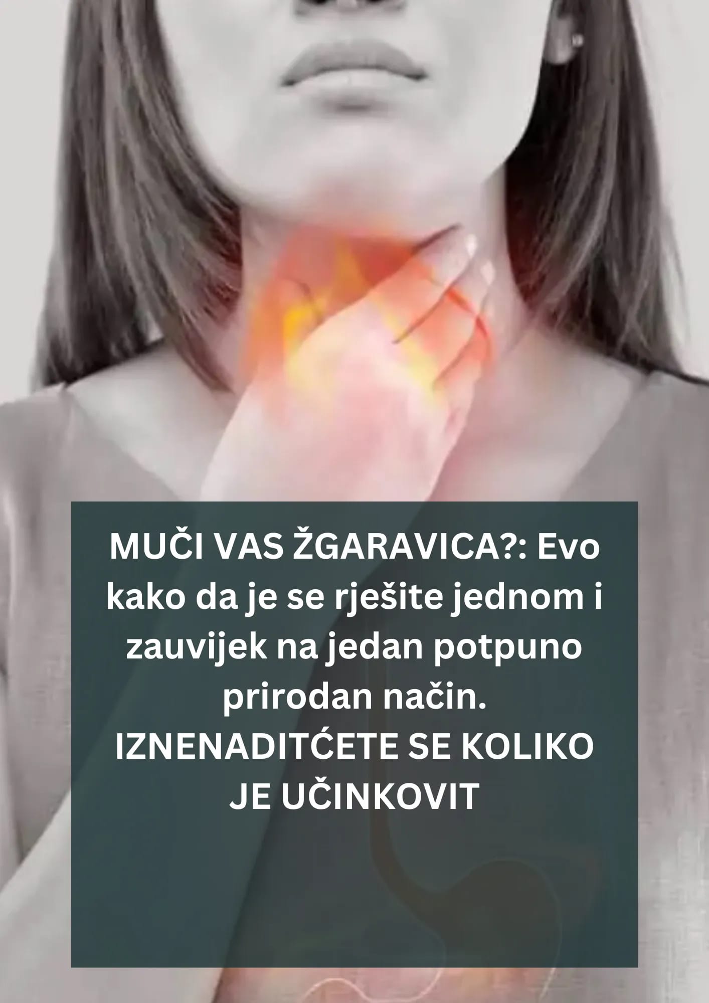 EVO KAKO DA SE NA PRIRODAN NAČIN RIJEŠITE ŽGARAVICE