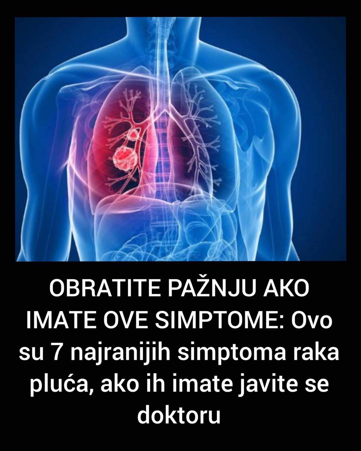 POGLEDAJTE KOJI SU TO PRVI SIMPTOMI RAKA PLUCA