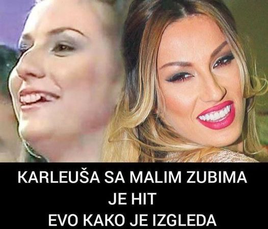 POGLEDAJTE KAKO SU SLAVNE LIČNOSTI IZGLEDALE PRIJE VJESTAČKIH ZUBA